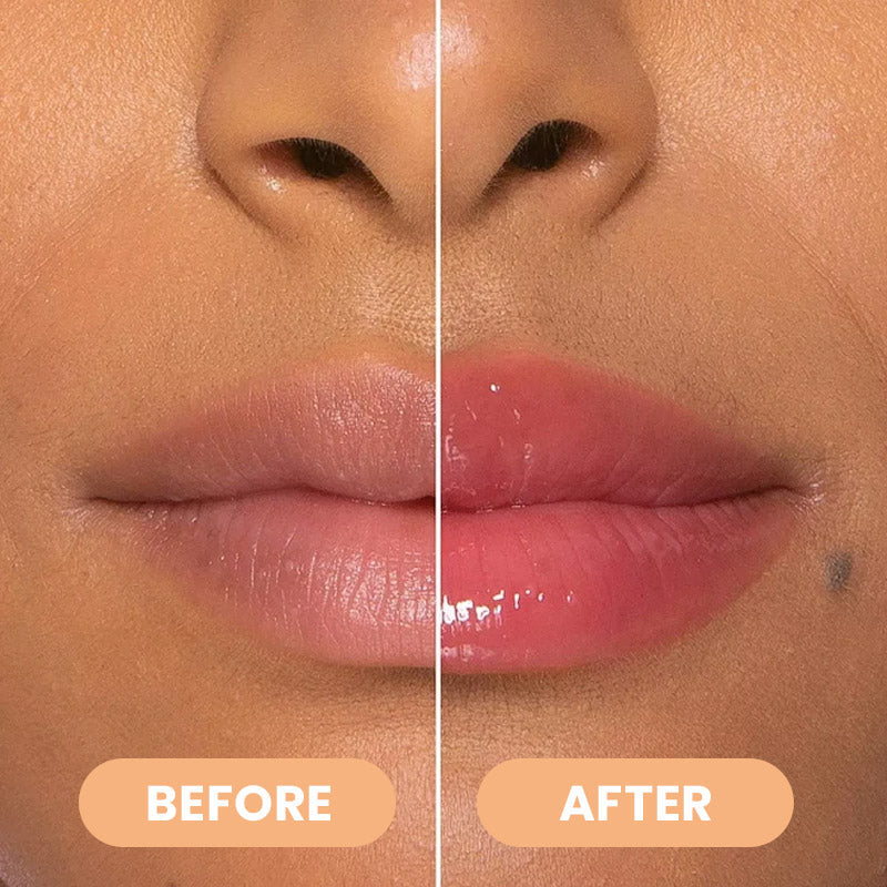 🔥2026 New Upgrade & Hot Sale🔥Sweet Pink Duo