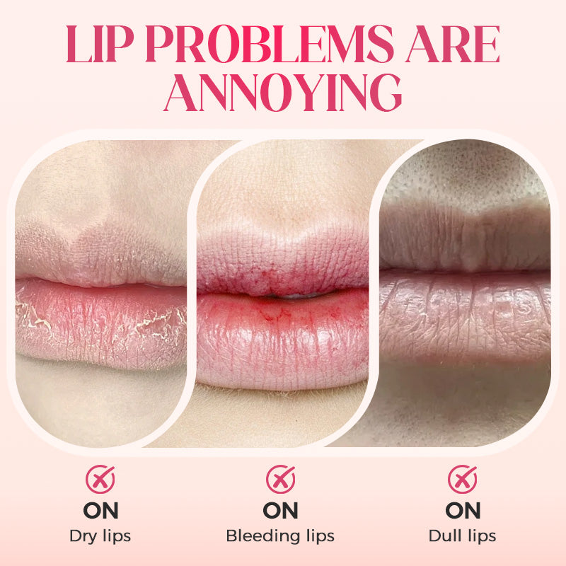 ⚡50K+ SOLD!✨Nooni Apple Hydrating Moisturizer Plump Transfer-proof Glossy Lip Stain Oil💋